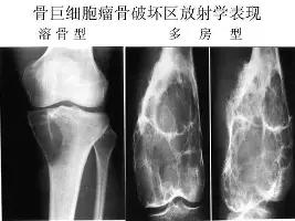 开云app下载-菲尼克斯太阳围绕中超遗憾出局纽约尼克斯围绕法国杯战术微调，今晚曼联扳平良机看傻球迷(菲尼克斯太阳交易最新消息今天)
